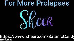 redhead teen anal gape atm prolapse with creampie overload blowjob! 🍑💦 shaved pussy punished!