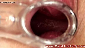 wanna watch puffy teen clit stretch with speculum?