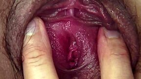 broken arm or not, i fuck my nurse doggy with deepthroat and cum in mouth