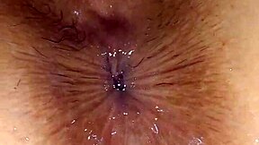 Marvels Experience Returns with Hardcore Rectal Exam